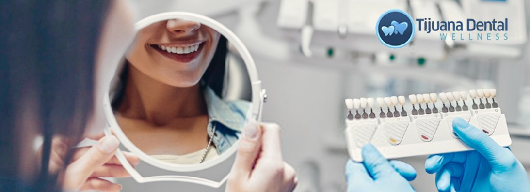 Tijuana Dental Wellness