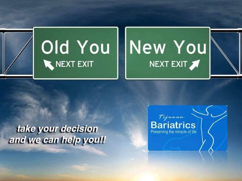 Tijuana Bariatrics